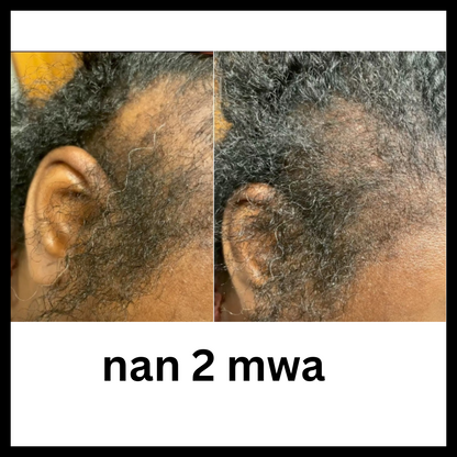 Lwil Kemiri BaliAga – Lwil Natirèl pou Cheve | Fè Cheve Grandi, Nouri Po Tèt, Repare Pwent Fann
